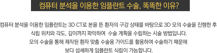 똑똑한 이유